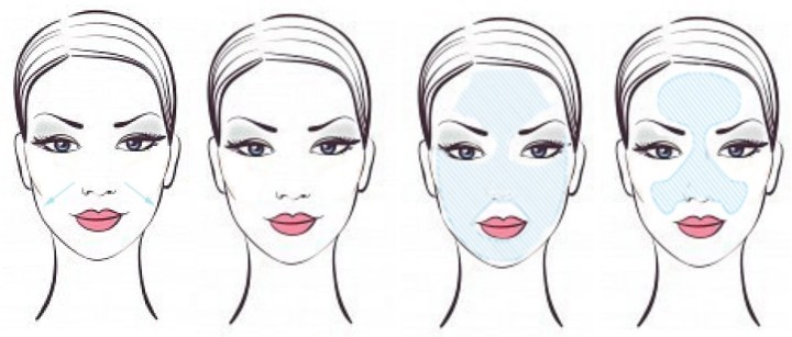 SKIN-TYPE