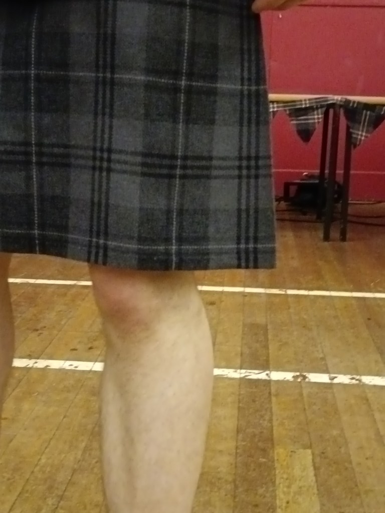 Close up of Kit's knee and his cute kilt